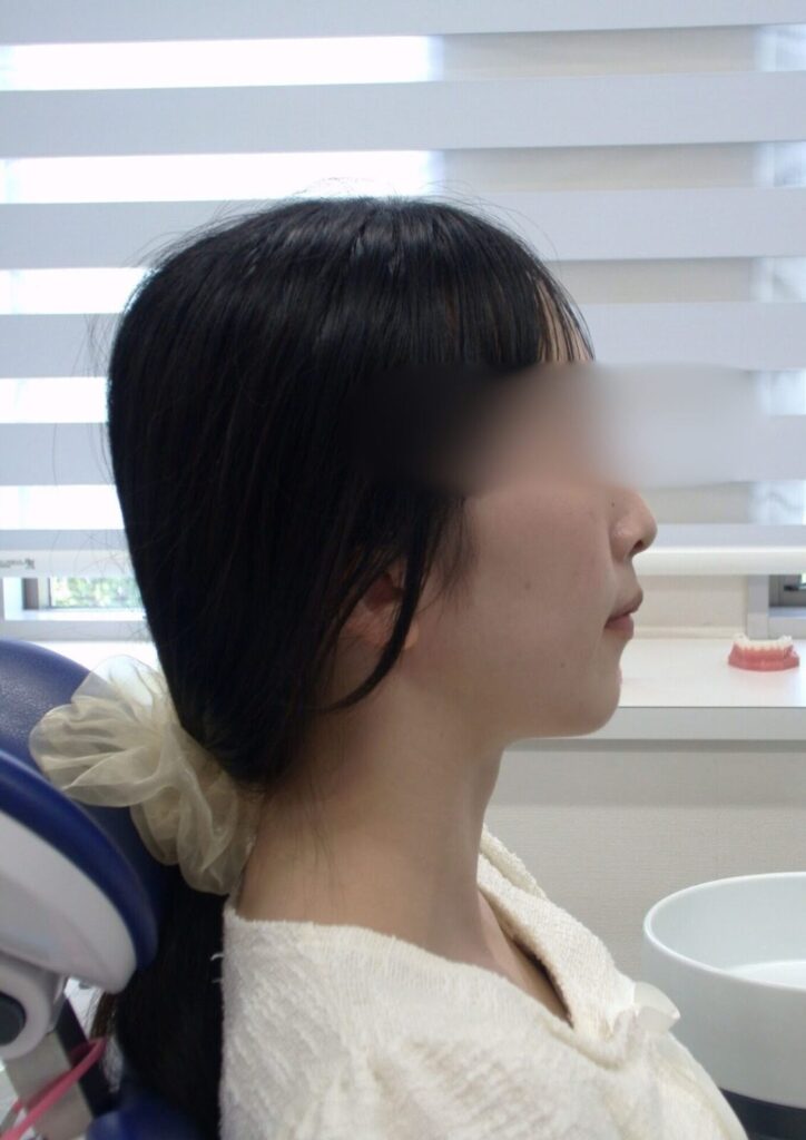 治療開始１年８ヶ月