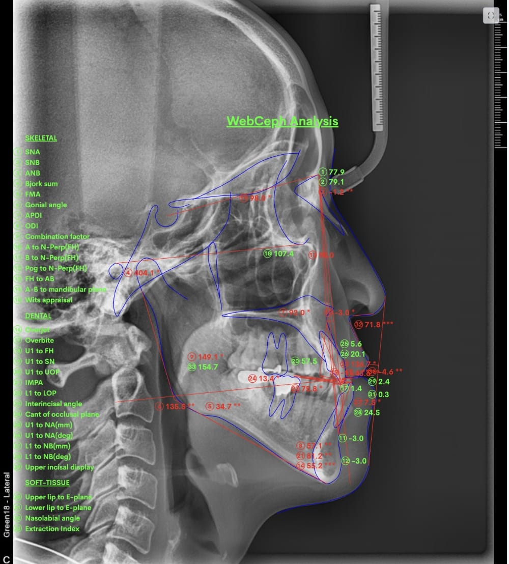 セファロX線写真