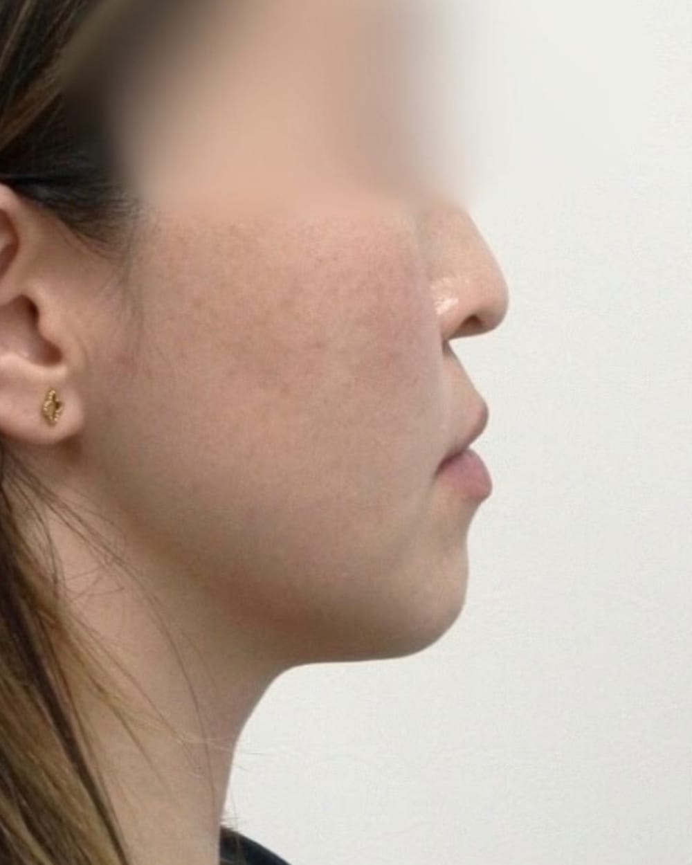 治療中の直近の写真