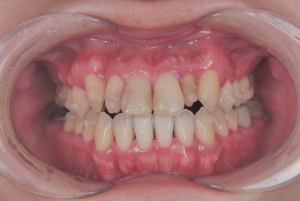 治療中の直近の写真