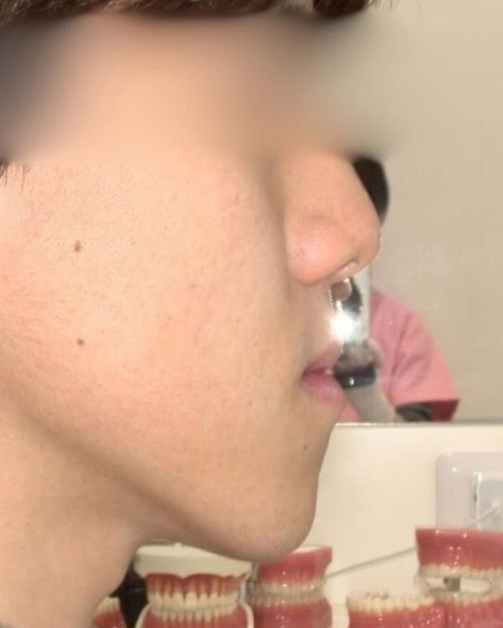 口元の突出感や後退感が強調される