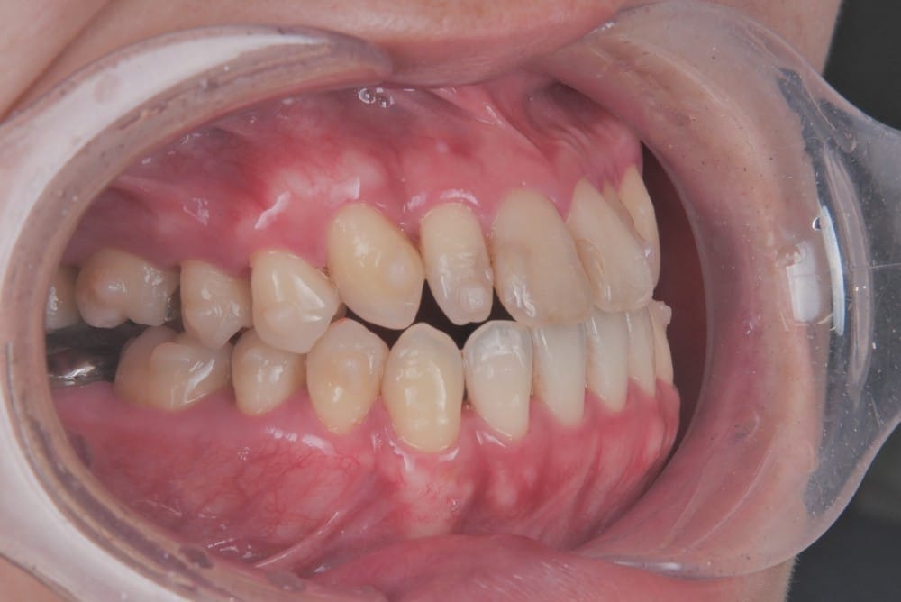 治療中の直近の写真