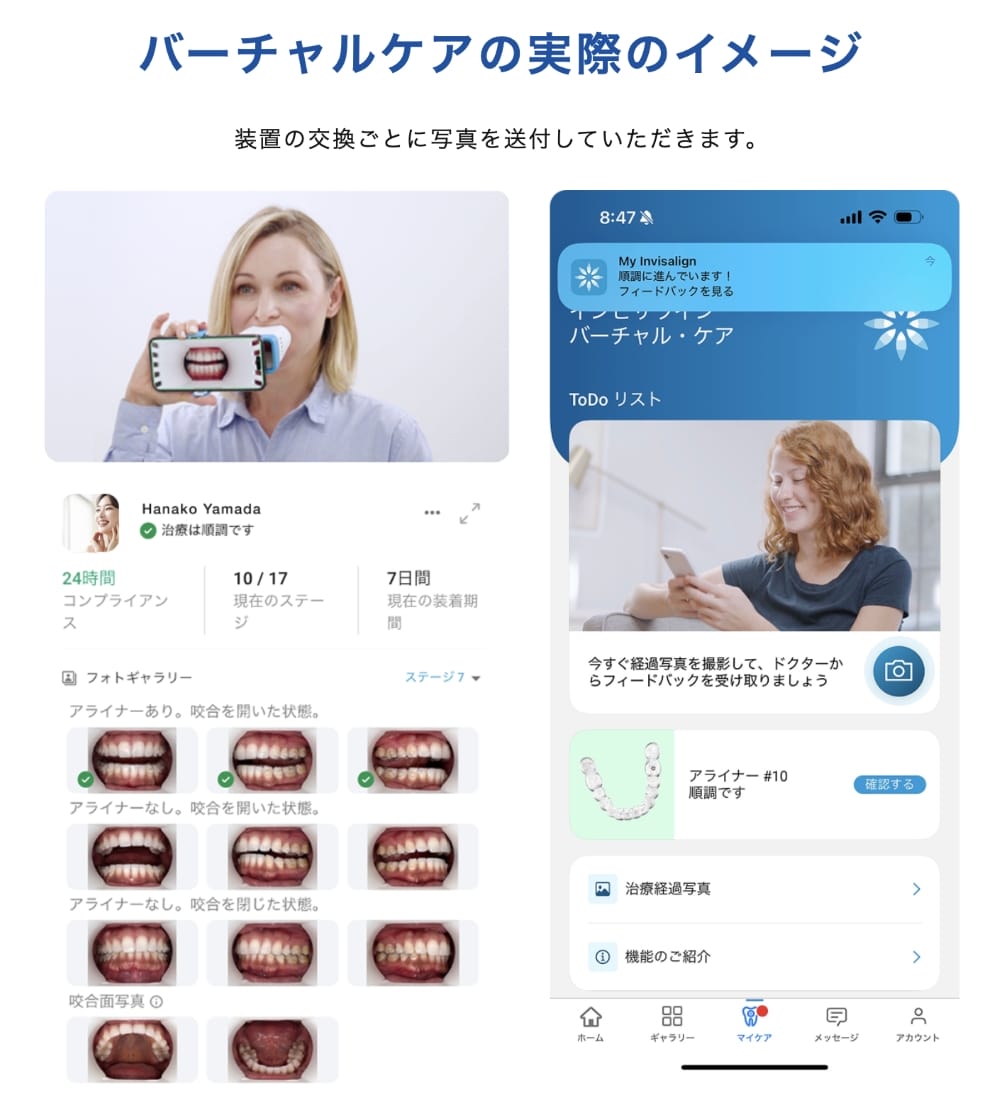 バーチャルケアの実際のイメージ