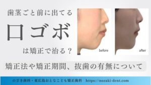 歯茎ごと前に出てる口ゴボは矯正で治る？治療法や矯正期間、抜歯の有無について