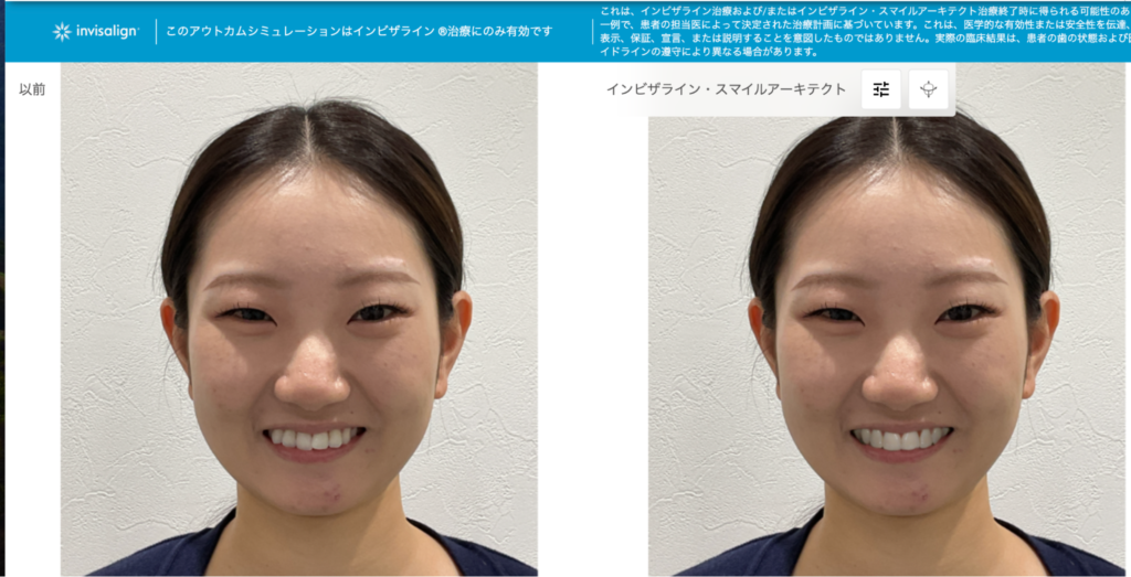 当院スタッフで了解が得れているため、目隠しなしにしております