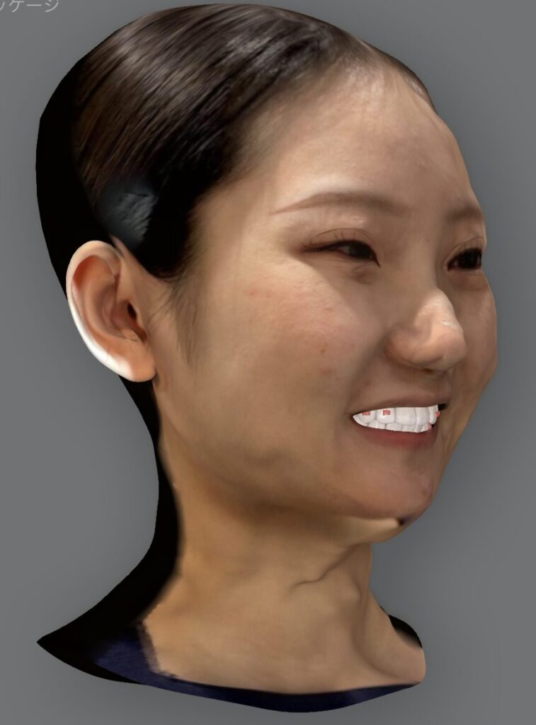 フェイシャルスキャン