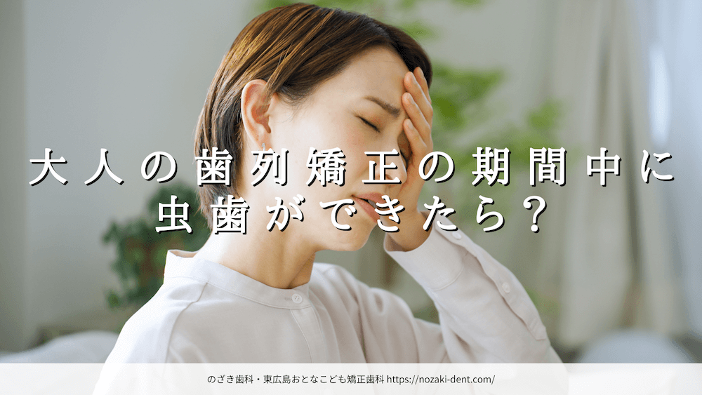 大人の歯列矯正の期間中に虫歯ができたら?中断の目安と対処