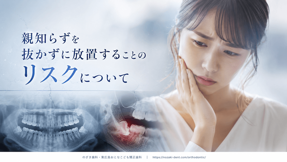 親知らずを抜かずに放置することのリスクについて