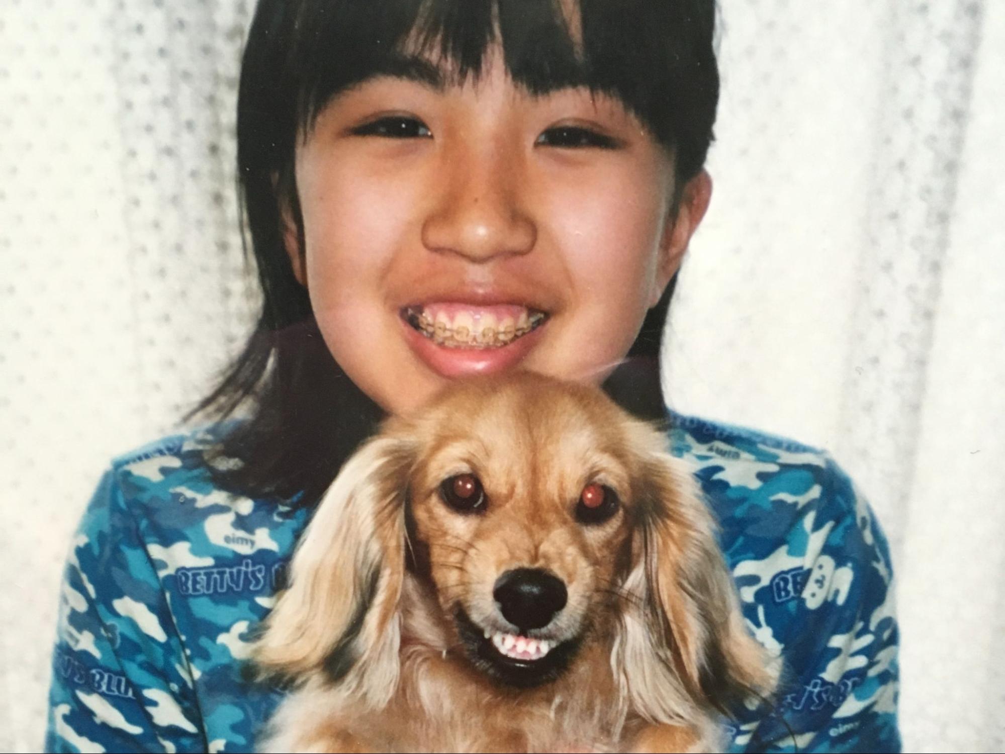 ワイヤー矯正中の写真