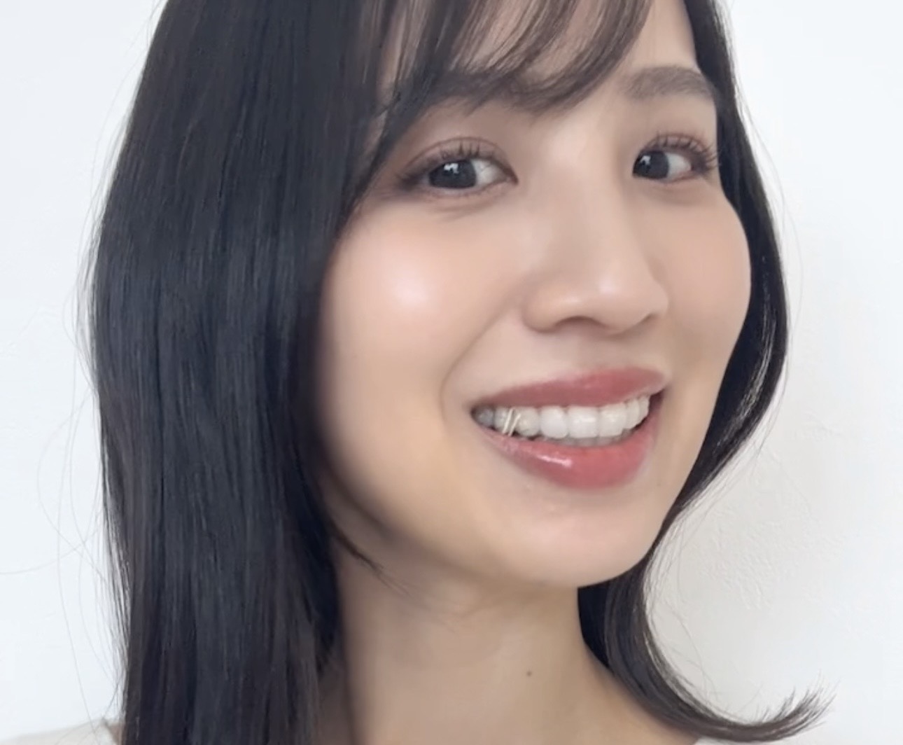現在マウスピース矯正中の写真