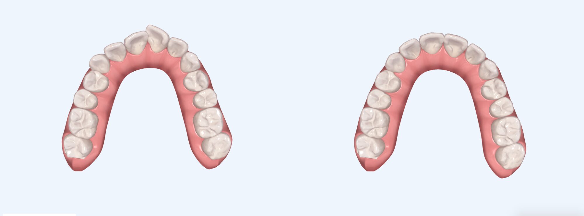 アフターイメージ画像