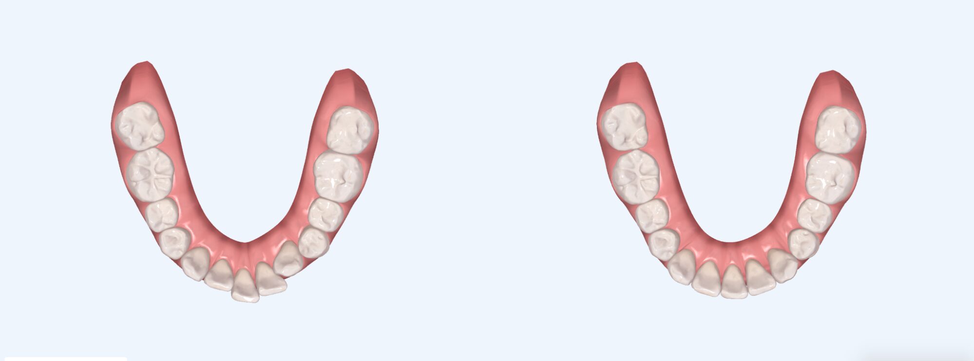 アフターイメージ画像