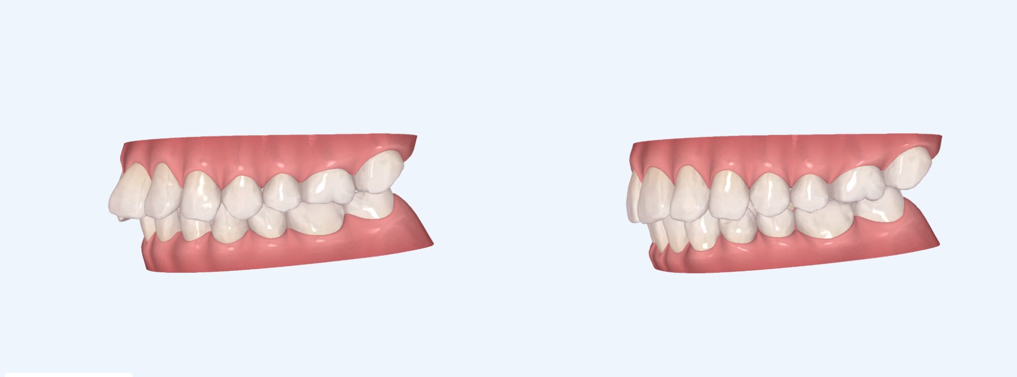 アフターイメージ画像