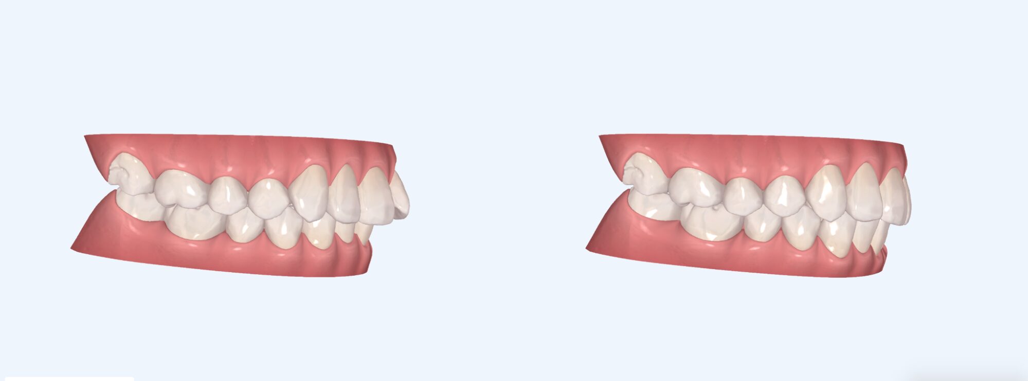 アフターイメージ画像