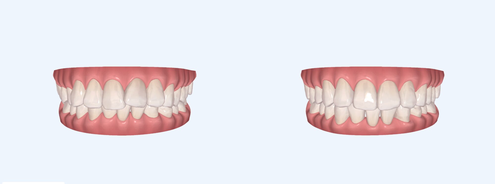 アフターイメージ画像
