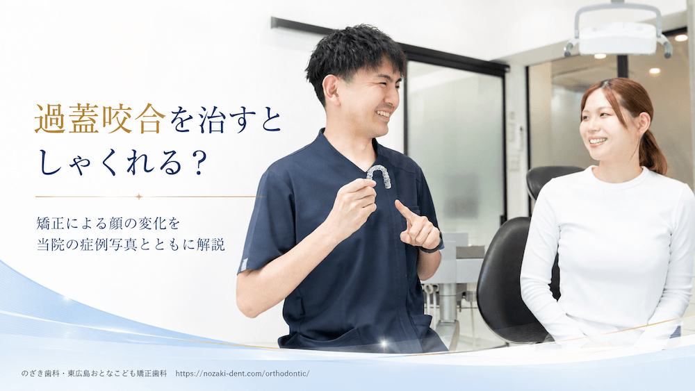 過蓋咬合を治すとしゃくれる？矯正による顔の変化を当院の症例写真とともに解説