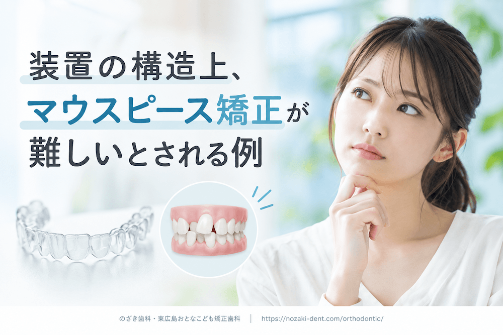 装置の構造上、マウスピース矯正が難しいとされる例