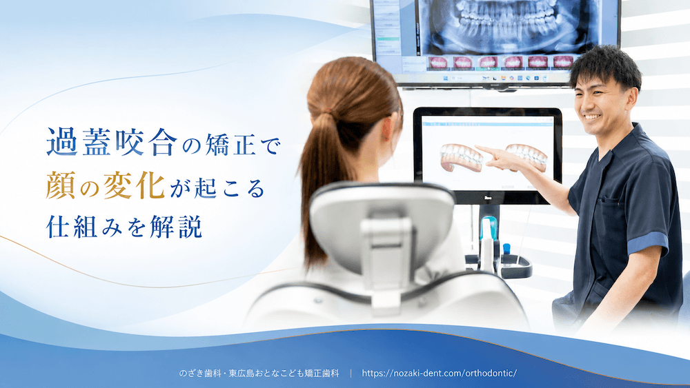 過蓋咬合の矯正で顔の変化が起こる仕組みを解説