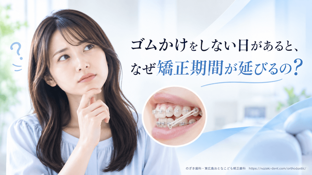 ゴムかけをしない日があると、なぜ矯正期間が延びるのか