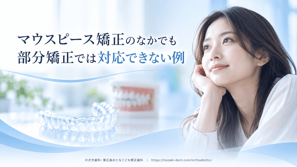 マウスピース矯正のなかでも部分矯正では対応できない例