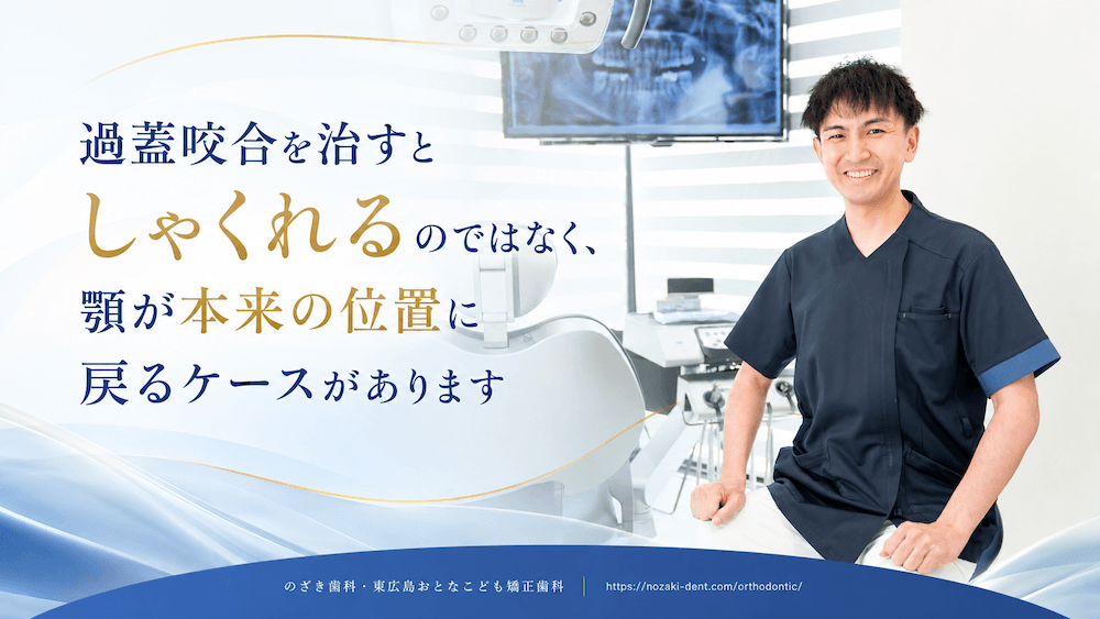 まとめ:過蓋咬合を治すとしゃくれるのではなく、顎が本来の位置に戻るケースがあります
