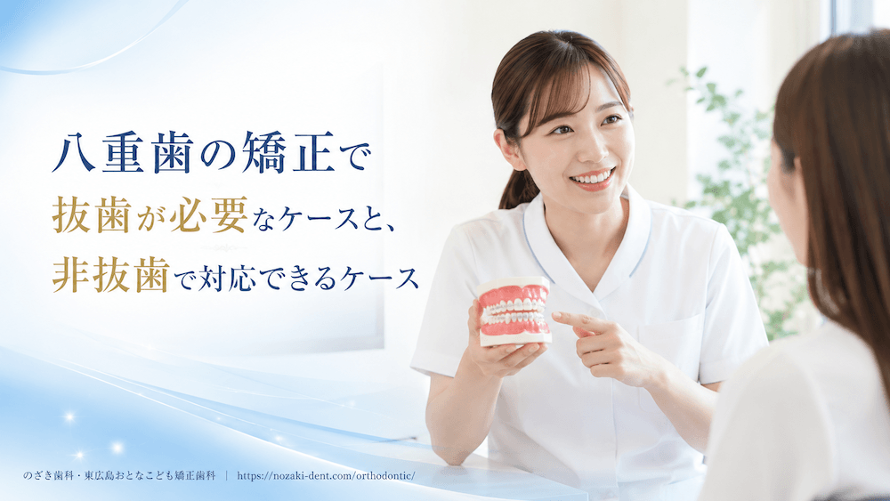 八重歯の矯正で抜歯が必要なケースと、非抜歯で対応できるケース