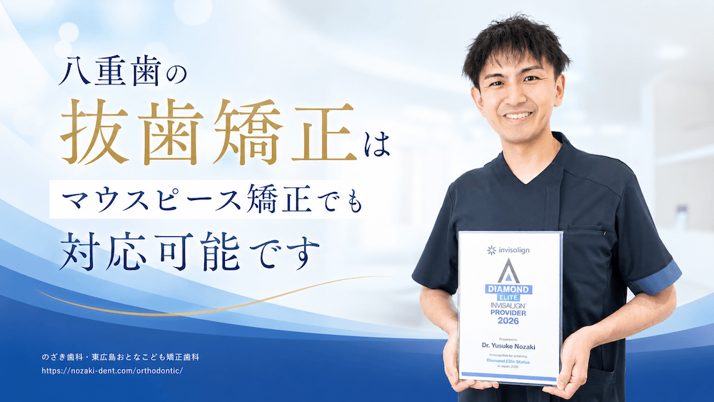 八重歯の抜歯矯正はマウスピース矯正でも対応可能です