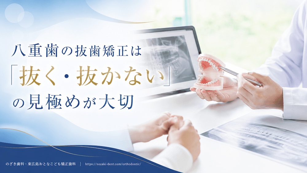 まとめ：八重歯の抜歯矯正は「抜く・抜かない」の見極めが大切