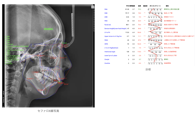 セファロX線写真