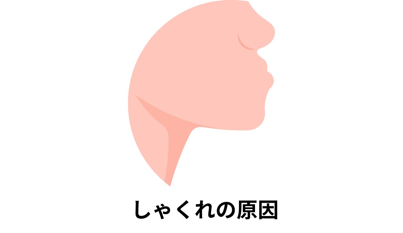 しゃくれの原因とは?受け口との違いや治療法について解説! | 東広島市で矯正治療なら|のざき歯科・東広島おとなこども矯正歯科