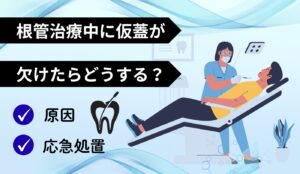 根管治療　仮蓋　欠けた　　応急処置