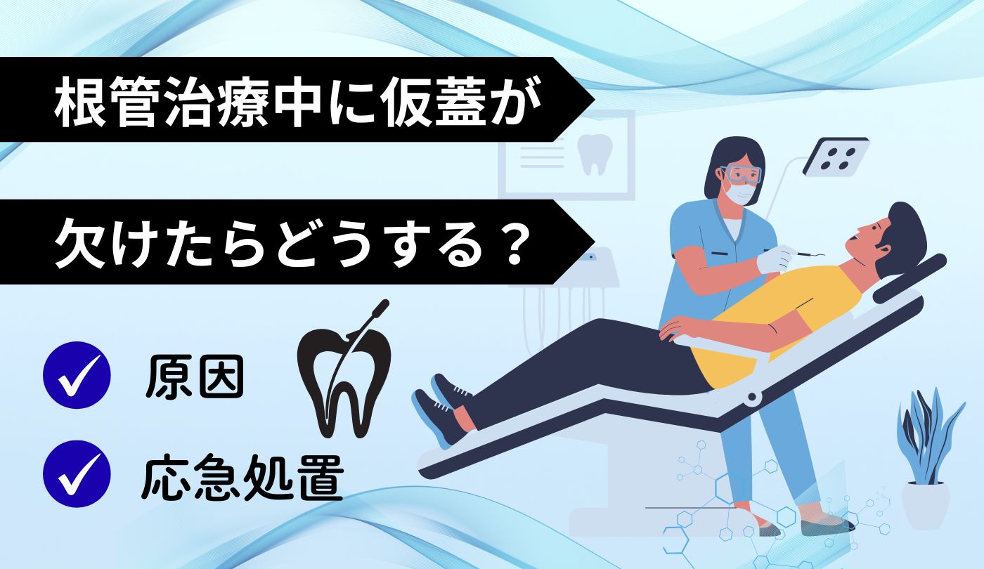 根管治療　仮蓋　欠けた　　応急処置