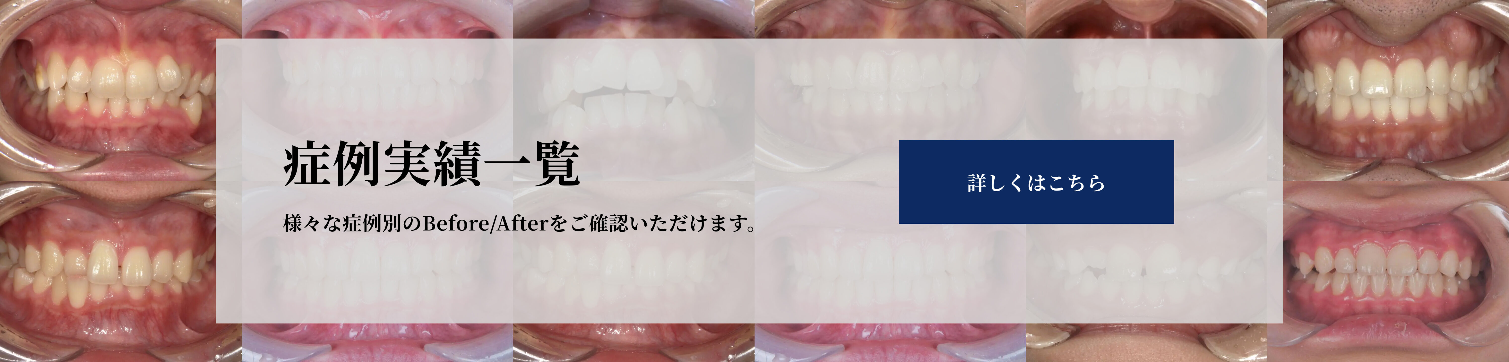 症例実績一覧へ