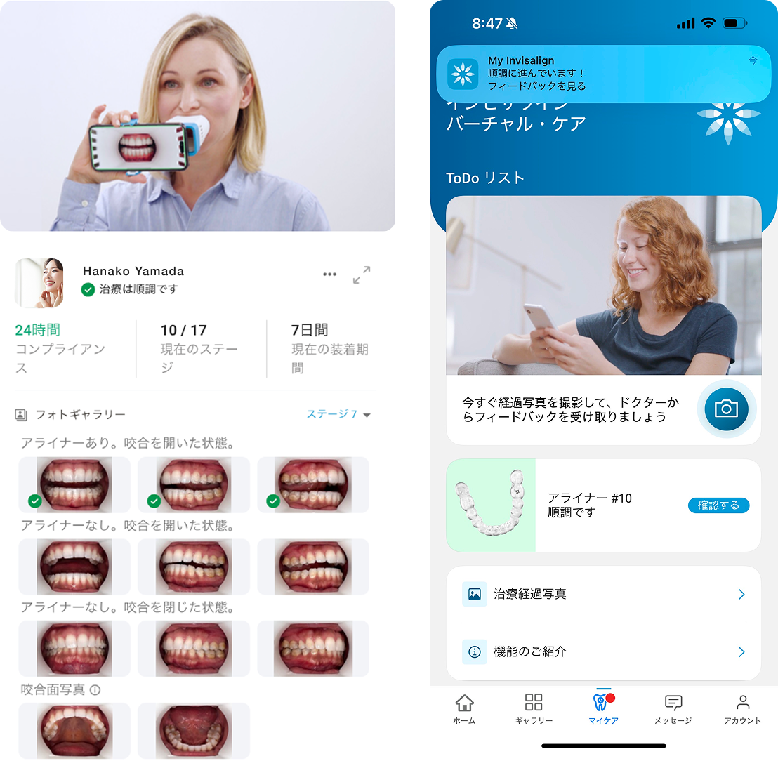 バーチャルケアイメージ