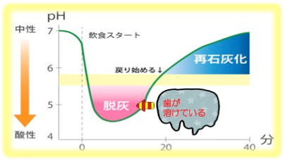 ステファンカーブ