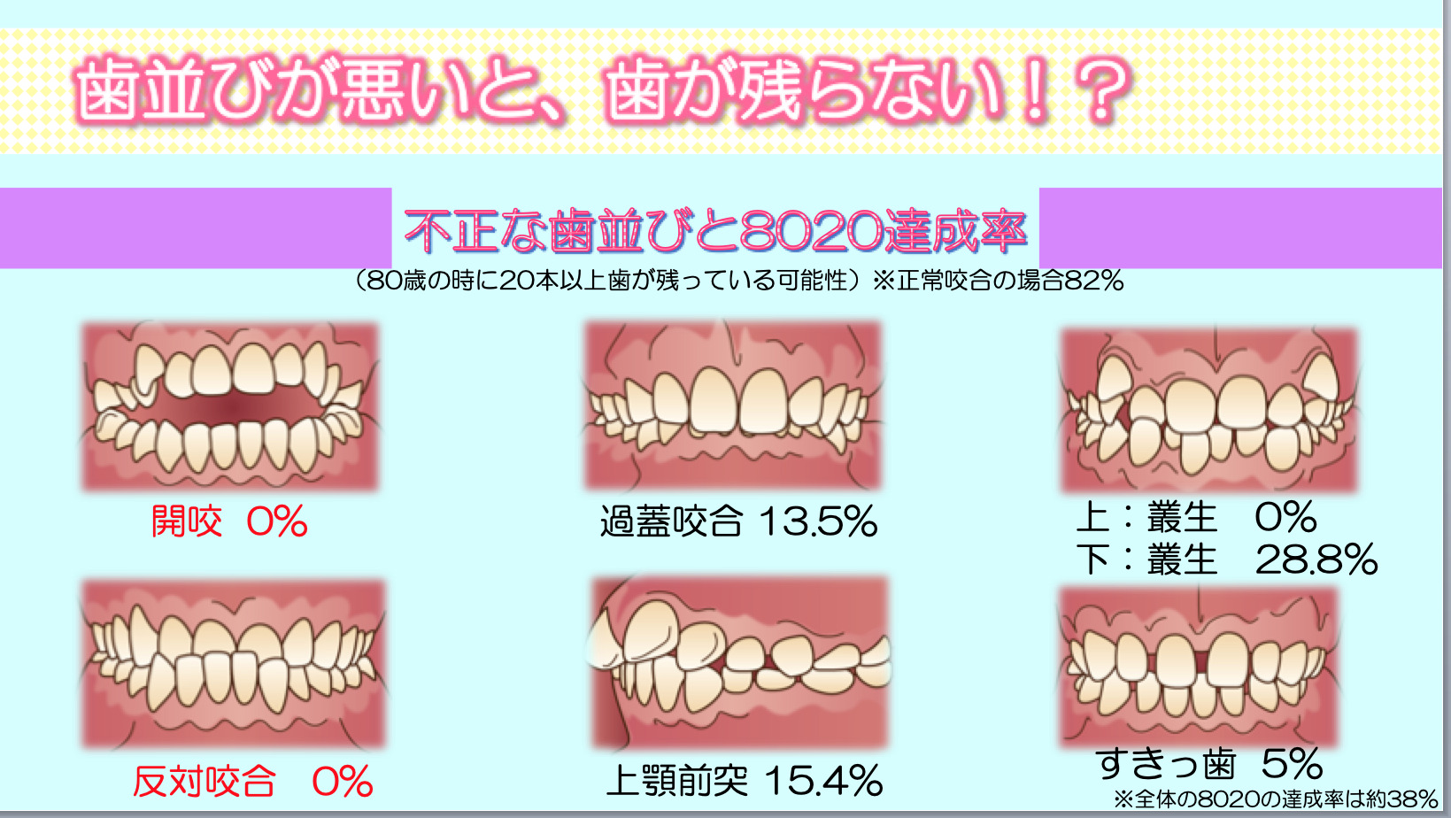 歯並びと歯の喪失