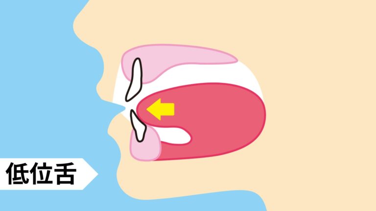 舌の正しい位置を知ろう|改善トレーニング方法を解説!
