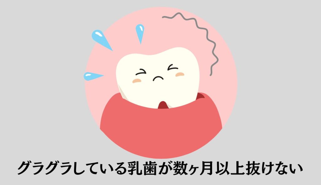 歯がグラグラ 抜けない
