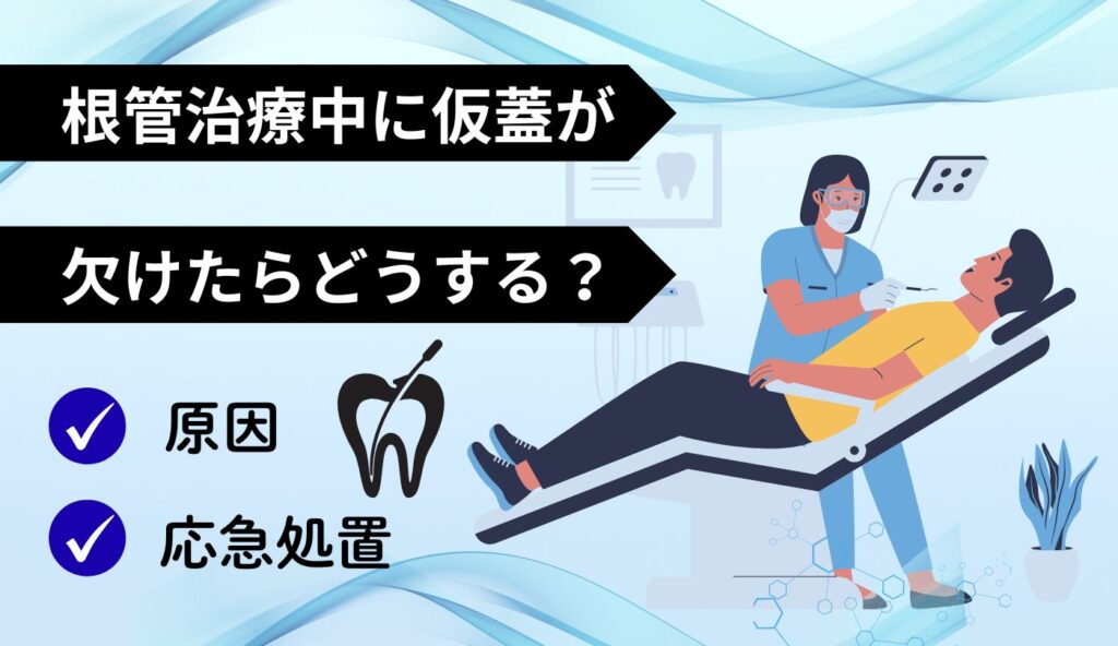根管治療　仮蓋　欠けた